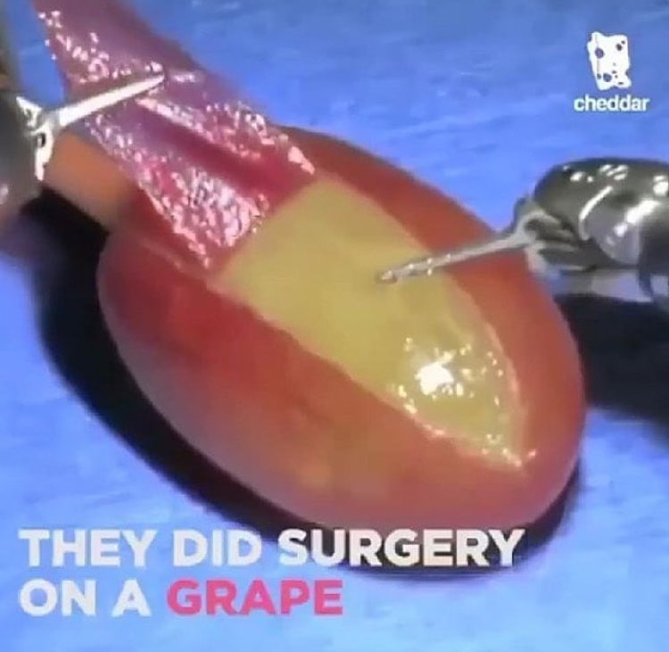 Они сделали операцию виноградинке